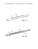 Apparatus and Method for Manipulating or Retracting Tissue and Anatomical     Structure diagram and image