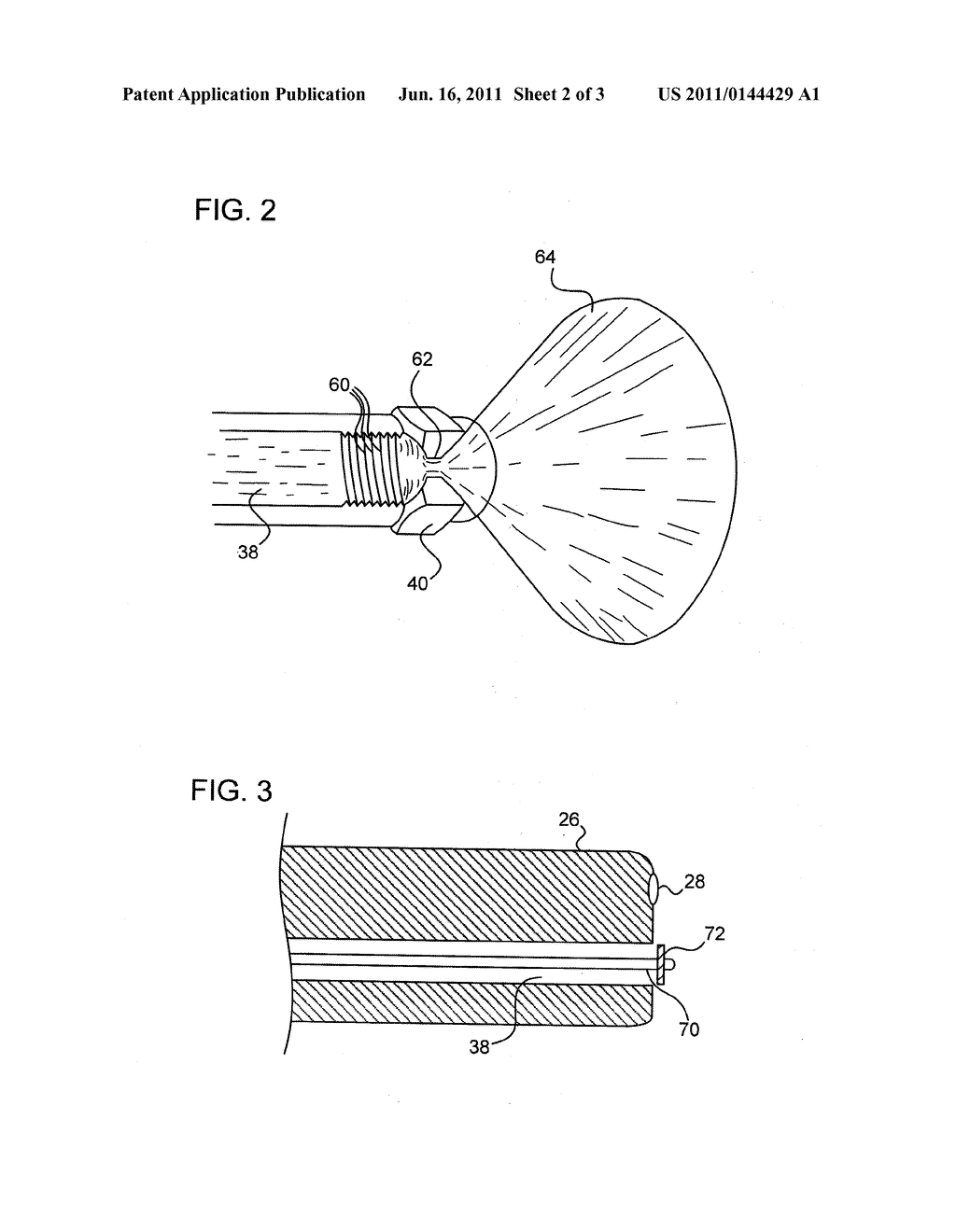 ENDOSCOPE WITH AN IMPROVED WORKING CHANNEL - diagram, schematic, and image 03