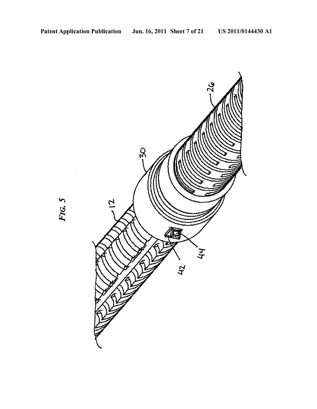 ARTICULATING ENDOSCOPIC ACCESSORY CHANNEL - diagram, schematic, and image 08