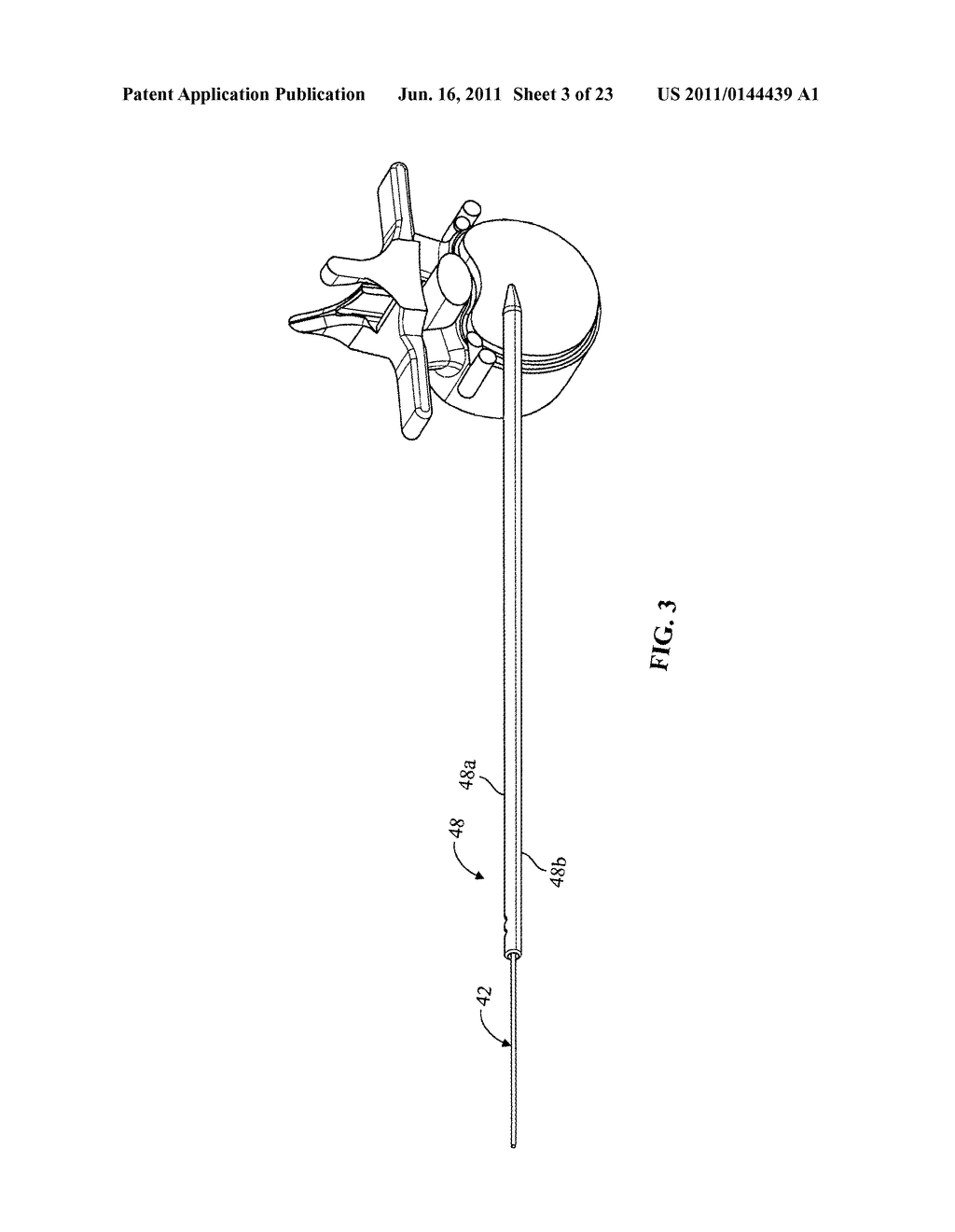 SURGICAL ACCESS SYSTEM AND RELATED METHODS - diagram, schematic, and image 04