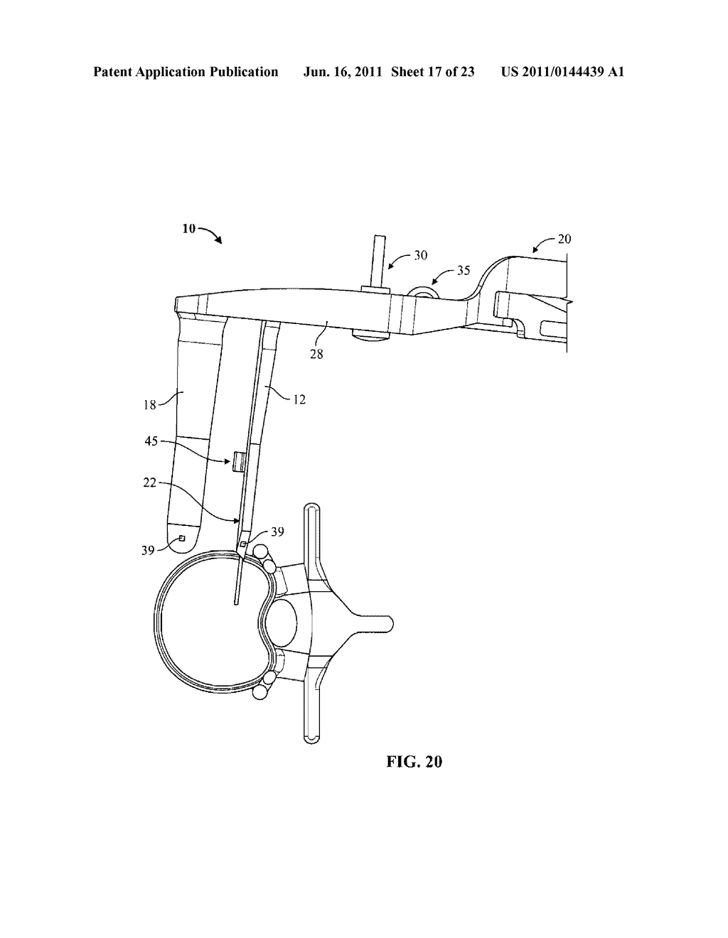 SURGICAL ACCESS SYSTEM AND RELATED METHODS - diagram, schematic, and image 18