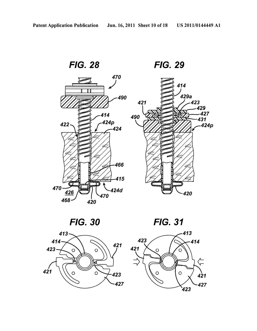 METHODS AND DEVICES FOR PROVIDING ACCESS THROUGH TISSUE TO A SURGICAL SITE - diagram, schematic, and image 11