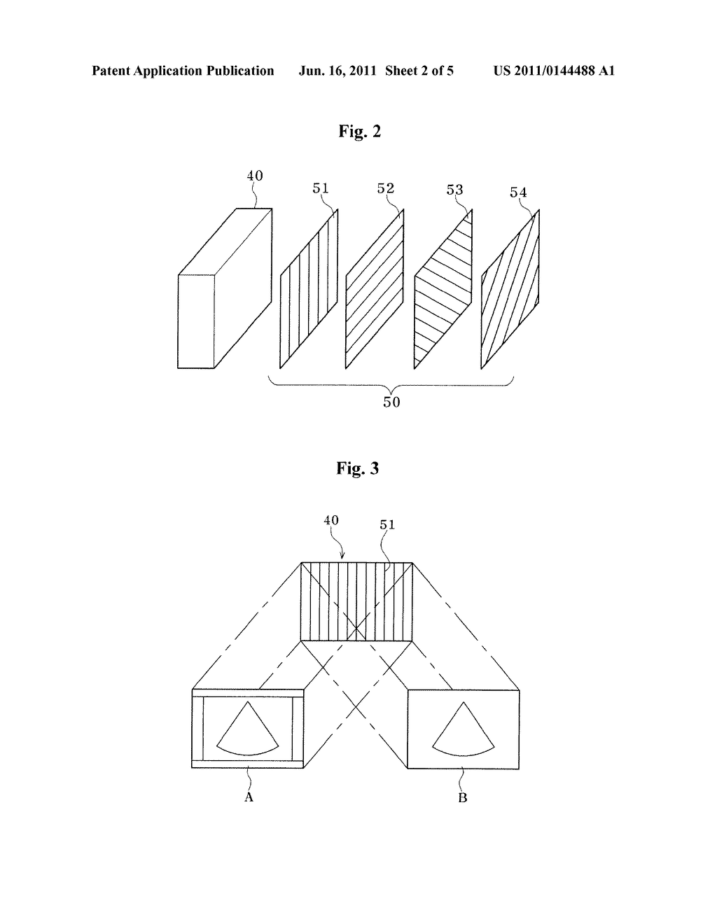 ULTRASOUND DIAGNOSTIC SYSTEM - diagram, schematic, and image 03