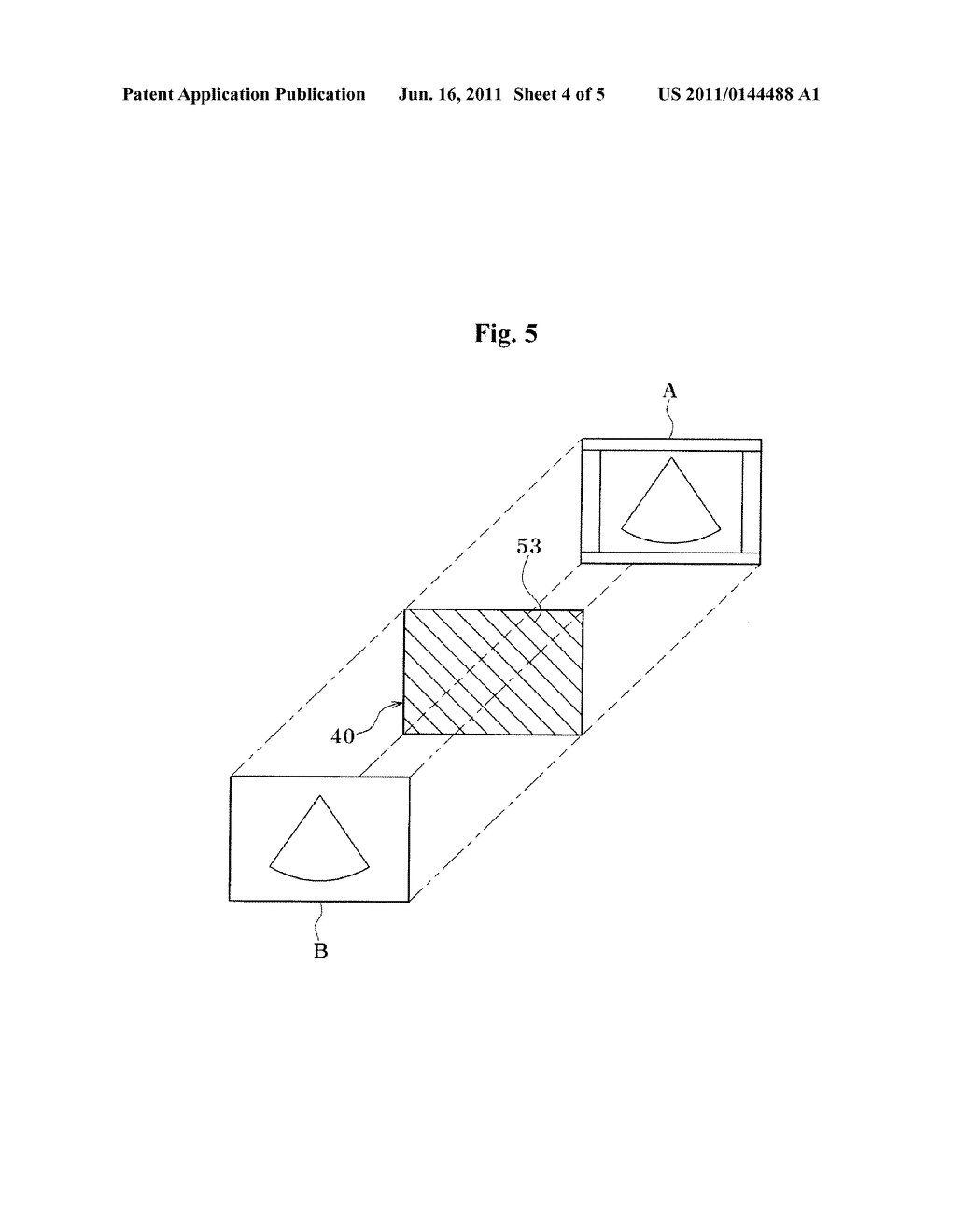 ULTRASOUND DIAGNOSTIC SYSTEM - diagram, schematic, and image 05