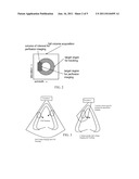 Perfusion Imaging of a Volume in Medical Diagnostic Ultrasound diagram and image