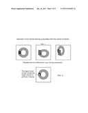 Perfusion Imaging of a Volume in Medical Diagnostic Ultrasound diagram and image