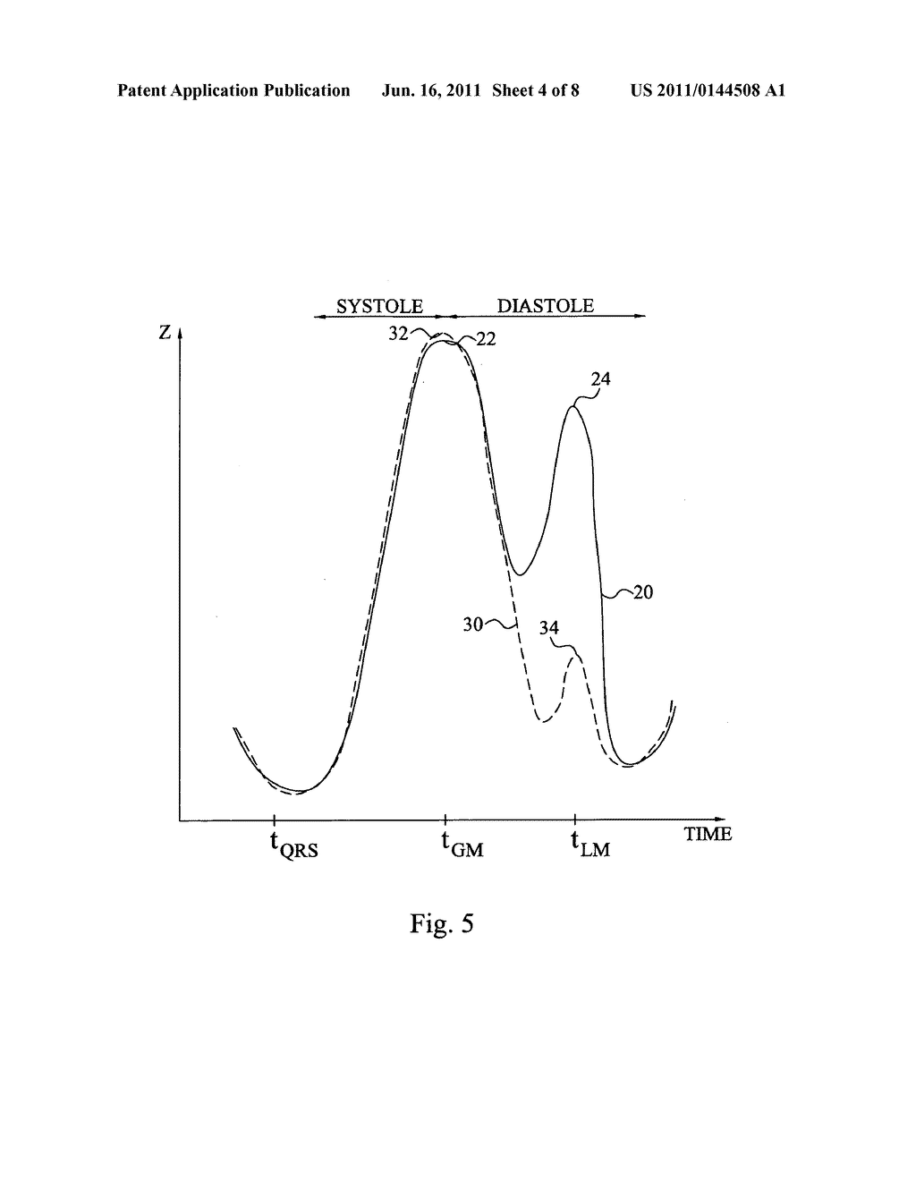 METHOD AND DEVICE FOR MONITORING ACUTE DECOMPENSATED HEART FAILURE - diagram, schematic, and image 05