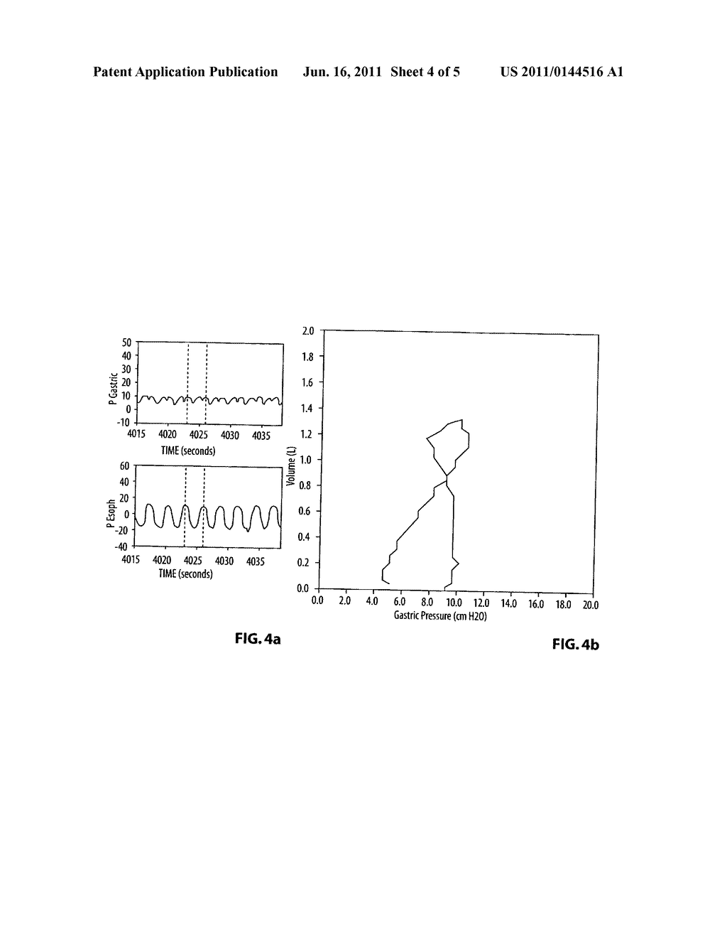 RELATIVE CONTRIBUTION OF THORACIC MUSCLES TO BREATHING - diagram, schematic, and image 05