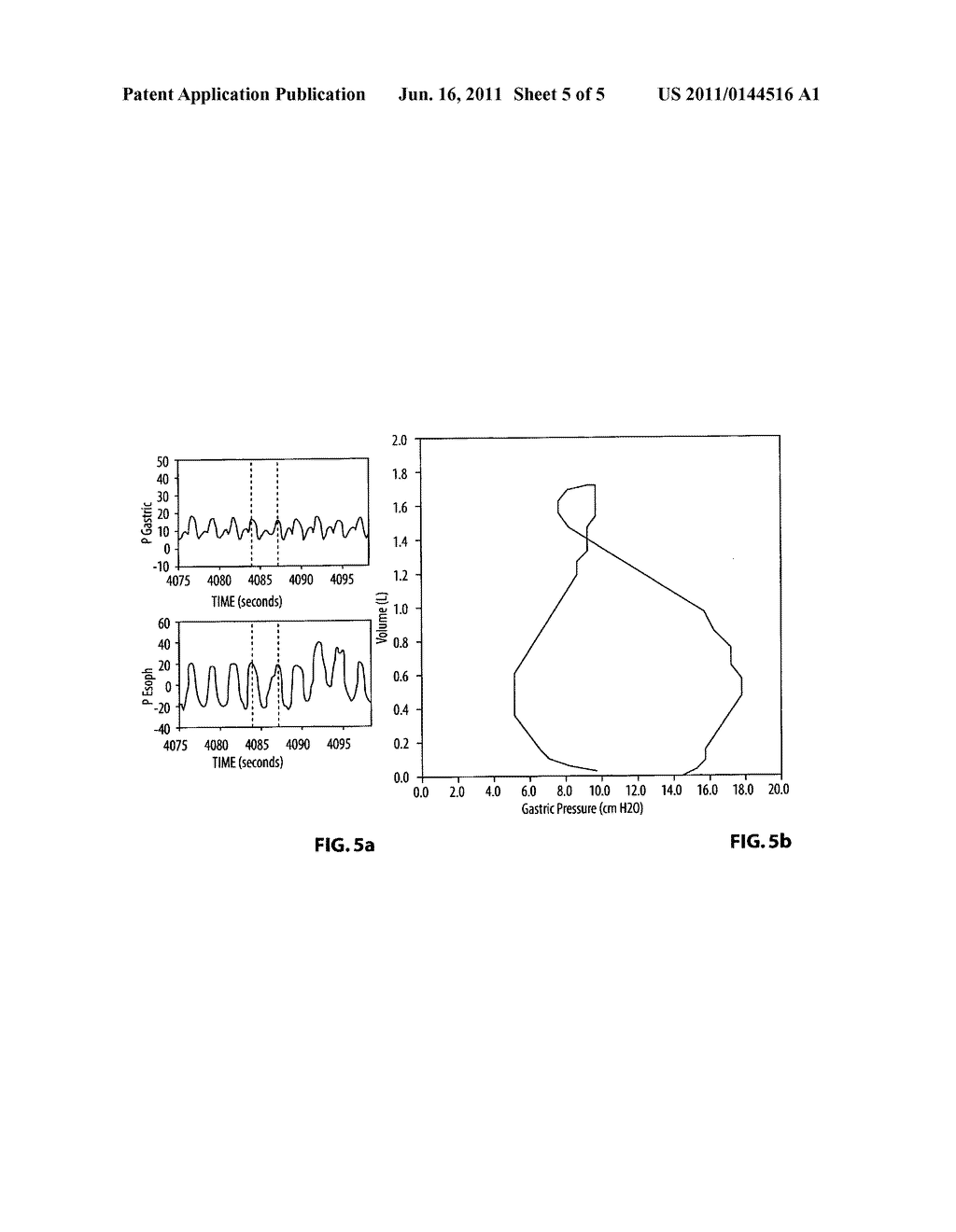 RELATIVE CONTRIBUTION OF THORACIC MUSCLES TO BREATHING - diagram, schematic, and image 06