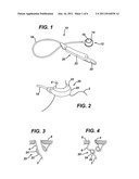 Pressure Sensing Adapter for Gastric Band System Injector diagram and image