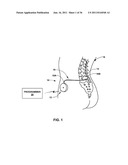 MONITORING CONDITIONS OF IMPLANTABLE MEDICAL FLUID DELIVERY DEVICE diagram and image