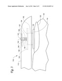 DIP JOINT EXTENSION SPLINT diagram and image