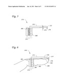 DIP JOINT EXTENSION SPLINT diagram and image