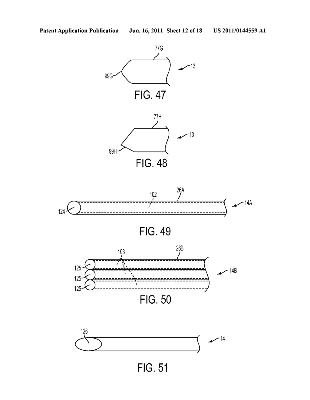 MEDICAL DRAINAGE DEVICES WITH CARBON-BASED STRUCTURES FOR INHIBITING     GROWTH OF FIBROBLASTS - diagram, schematic, and image 13