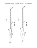 SIDE BRANCH BALLOON diagram and image