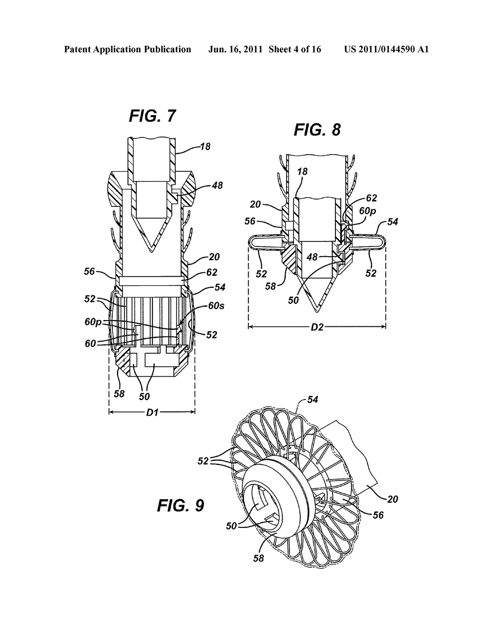 METHODS AND DEVICES FOR PROVIDING ACCESS THROUGH TISSUE TO A SURGICAL SITE - diagram, schematic, and image 05