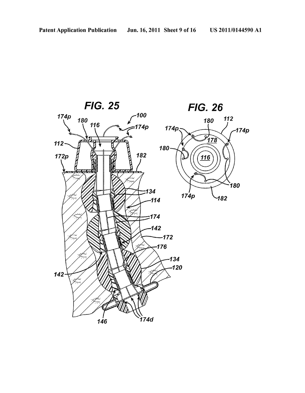 METHODS AND DEVICES FOR PROVIDING ACCESS THROUGH TISSUE TO A SURGICAL SITE - diagram, schematic, and image 10