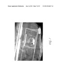 MEMS DEVICE AND METHOD FOR DELIVERY OF THERAPEUTIC AGENTS diagram and image