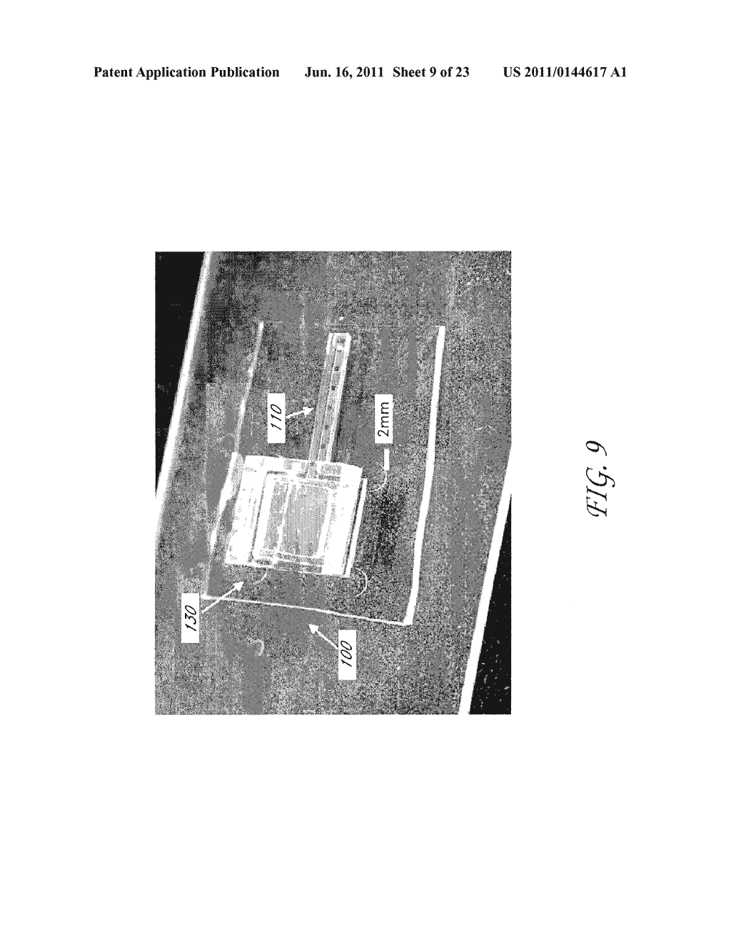 MEMS DEVICE AND METHOD FOR DELIVERY OF THERAPEUTIC AGENTS - diagram, schematic, and image 10