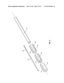 High-Intensity Pulsed Electric Field Vitrectomy Apparatus diagram and image