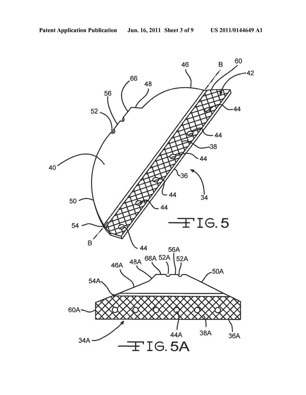 Disposable Flex Reamer - diagram, schematic, and image 04