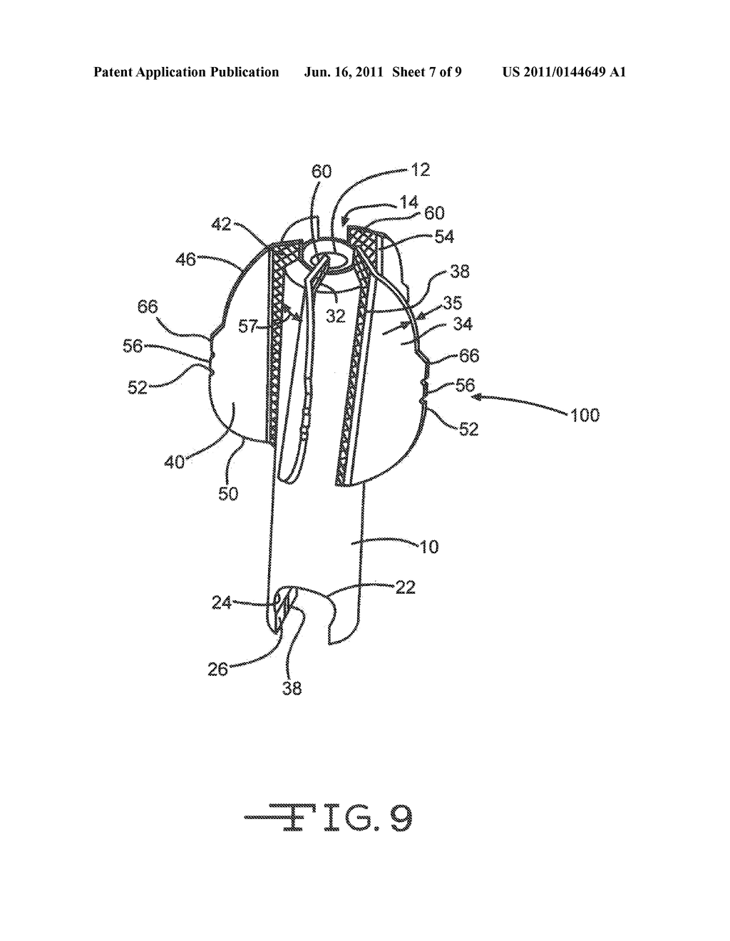 Disposable Flex Reamer - diagram, schematic, and image 08