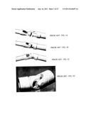 N DEGREES-OF-FREEDOM (DOF) LAPAROSCOPE MANEUVERABLE SYSTEM diagram and image