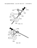 N DEGREES-OF-FREEDOM (DOF) LAPAROSCOPE MANEUVERABLE SYSTEM diagram and image