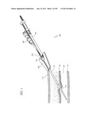 TISSUE CLOSURE DEVICES, DEVICE AND SYSTEMS FOR DELIVERY, KITS AND METHODS     THEREFOR diagram and image