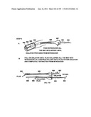 TISSUE CLOSURE DEVICES, DEVICE AND SYSTEMS FOR DELIVERY, KITS AND METHODS     THEREFOR diagram and image