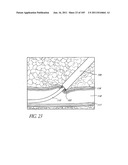 TISSUE CLOSURE DEVICES, DEVICE AND SYSTEMS FOR DELIVERY, KITS AND METHODS     THEREFOR diagram and image