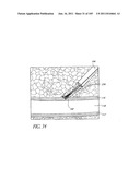 TISSUE CLOSURE DEVICES, DEVICE AND SYSTEMS FOR DELIVERY, KITS AND METHODS     THEREFOR diagram and image