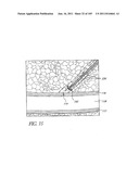 TISSUE CLOSURE DEVICES, DEVICE AND SYSTEMS FOR DELIVERY, KITS AND METHODS     THEREFOR diagram and image