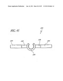 TISSUE CLOSURE DEVICES, DEVICE AND SYSTEMS FOR DELIVERY, KITS AND METHODS     THEREFOR diagram and image