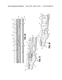 SURGICAL CLIP APPLIER diagram and image