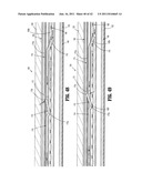 SURGICAL CLIP APPLIER diagram and image