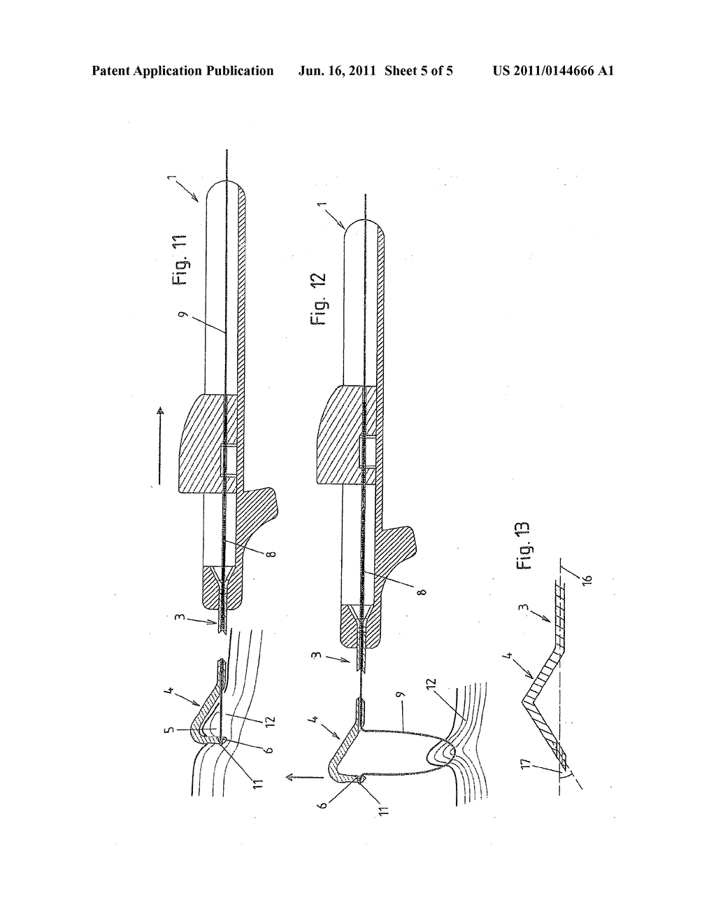 SURGICAL APPARATUS - diagram, schematic, and image 06