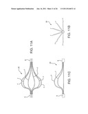 METHOD OF USING AN AORTIC DISSECTION SEPTAL CUTTING TOOL diagram and image