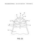 METHOD OF USING AN AORTIC DISSECTION SEPTAL CUTTING TOOL diagram and image