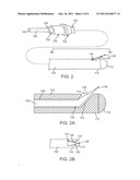 Methods and Systems for Bypassing an Occlusion in a Blood Vessel diagram and image