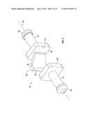 Dynamic Spine Stabilizers diagram and image