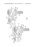 Dynamic Spine Stabilizers diagram and image