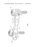 Dynamic Spine Stabilizers diagram and image