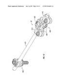 Dynamic Spine Stabilizers diagram and image