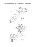 Dynamic Spine Stabilizers diagram and image