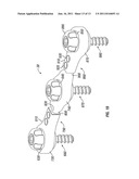 Dynamic Spine Stabilizers diagram and image