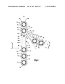 Mandibular Fixation Plate diagram and image