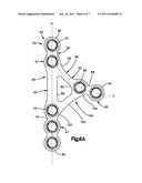 Mandibular Fixation Plate diagram and image