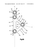 Mandibular Fixation Plate diagram and image