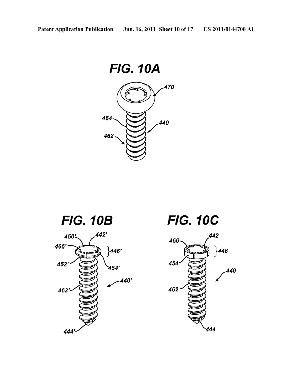 RESILIENT BONE PLATE AND SCREW SYSTEM ALLOWING BI-DIRECTIONAL ASSEMBLY - diagram, schematic, and image 11